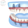 Dental Implants Claimings at DoctorPrem: Simplifying Your Dental Insurance Process grupi logo